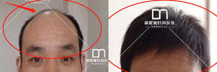 男士形象改造 | 拯救的不僅是外形，更是自信！